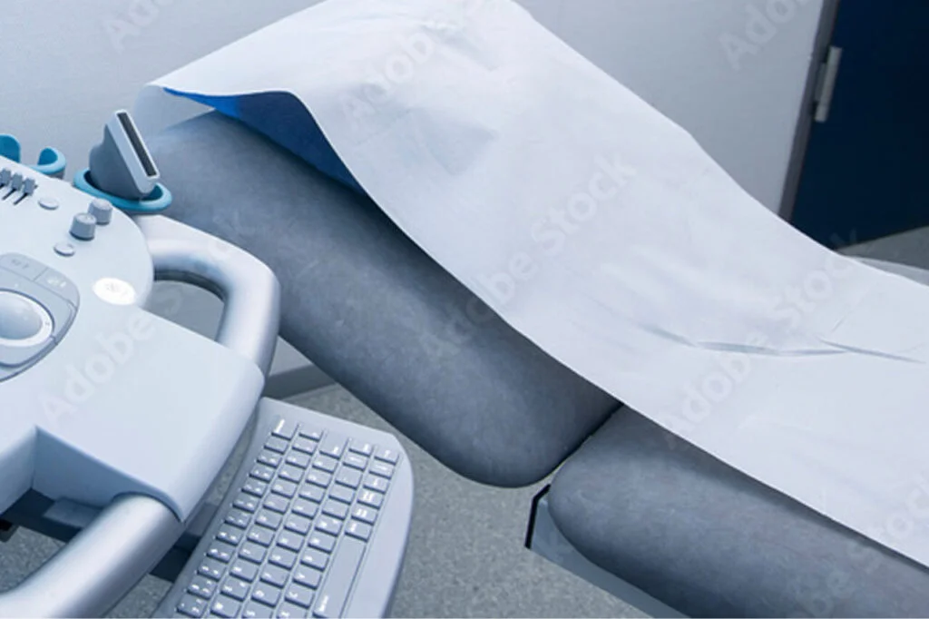 PCO Behandlung Venenstripping